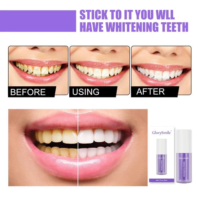 GLORYSMILE V34 - Dentifrice blanchissant New